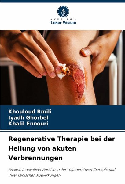 Regenerative Therapie bei der Heilung von akuten Verbrennungen Regenerative Therapie bei der Heilung von akuten Verbrennungen