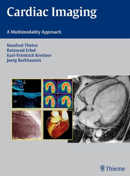 Cardiac Imaging (eBook, PDF)