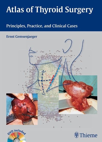Atlas of Thyroid Surgery (eBook, ePUB)