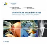 Osteotomies around the Knee (eBook, PDF)