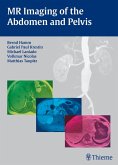 MR Imaging of the Abdomen and Pelvis (eBook, ePUB)