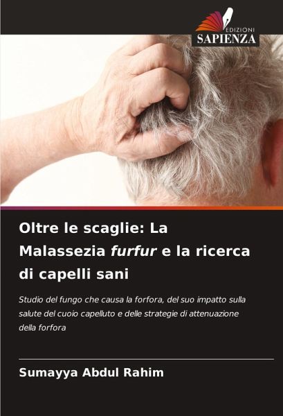 Oltre le scaglie: La Malassezia furfur e la ricerca di capelli sani Oltre le scaglie: La Malassezia furfur e la ricerca di capelli sani