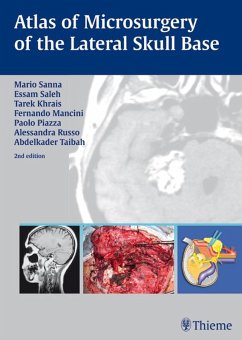 Atlas of Microsurgery of the Lateral Skull Base (eBook, ePUB) - Sanna, Mario; Khrais, Tarek; Mancini, Fernando; Saleh, Essam A.; Piazza, Paolo; Russo, Alessandra; Taibah, Abdelkader