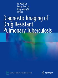 Cover Diagnostic Imaging of Drug Resistant Pulmonary Tuberculosis