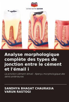 Analyse morphologique complète des types de jonction entre le cément et l'émail i - CHAURASIA, SANDHYA BHAGAT;Rastogi, Varun