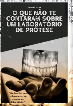 O Que Não Te Contaram Sobre Um Laboratório De Prótese (eBook, ePUB) - Lima, Daniel