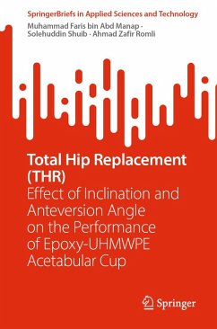 Cover Total Hip Replacement (THR) (eBook, PDF)