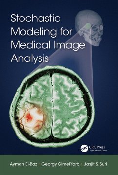 Cover Stochastic Modeling for Medical Image Analysis (eBook, ePUB)
