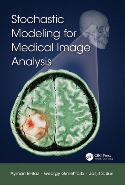 Stochastic Modeling for Medical Image Analysis (eBook, ePUB) Stochastic Modeling for Medical Image Analysis (eBook, ePUB)