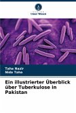 Ein illustrierter Überblick über Tuberkulose in Pakistan Ein illustrierter Überblick über Tuberkulose in Pakistan