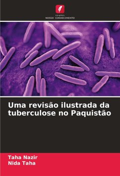 Cover Uma revisão ilustrada da tuberculose no Paquistão