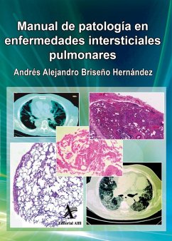 Cover Manual de patología en enfermedades intersticiales pulmonares (eBook, PDF)