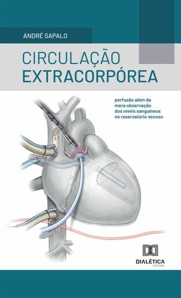 Circulação extracorpórea (eBook, ePUB)