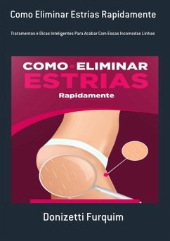 Como Eliminar Estrias Rapidamente (eBook, ePUB) - Furquim, Donizetti