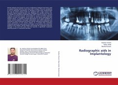 Radiographic aids in Implantology - Chand, Keshav;Jindal, Vikas;Kumari, Monika