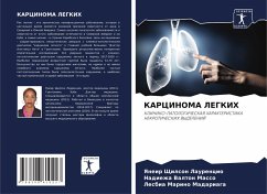 Cover KARCINOMA LEGKIH