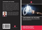 Carcinoma Do Pulmão