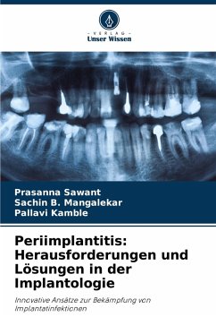 Cover Periimplantitis: Herausforderungen und Lösungen in der Implantologie