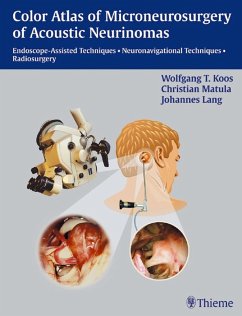 Cover Color Atlas of Microsurgery of Acoustic Neurinomas (eBook, ePUB)
