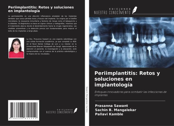Periimplantitis: Retos y soluciones en implantología