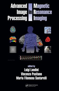 Cover Advanced Image Processing in Magnetic Resonance Imaging (eBook, ePUB)