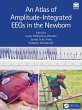 An Atlas of Amplitude-Integrated EEGs... - Bild 1