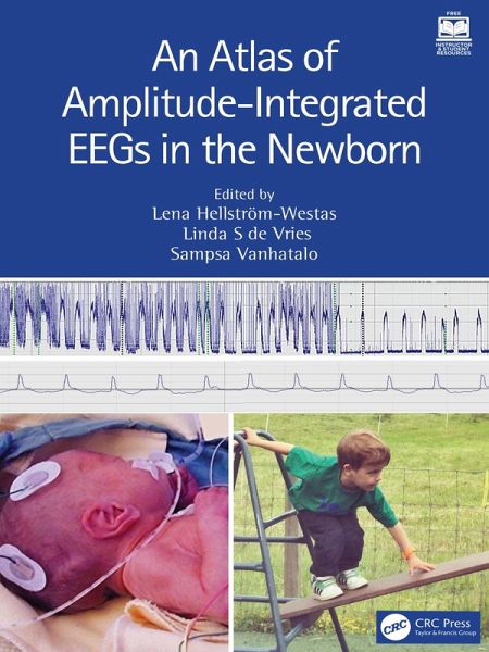 An Atlas of Amplitude-Integrated EEGs in the Newborn (eBook, ePUB)