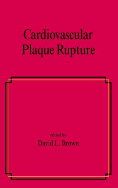 Cardiovascular Plaque Rupture (eBook, ePUB) Cardiovascular Plaque Rupture (eBook, ePUB)