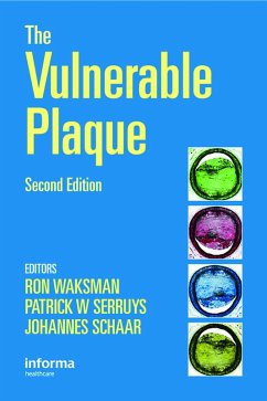 Cover Handbook of the Vulnerable Plaque (eBook, ePUB)