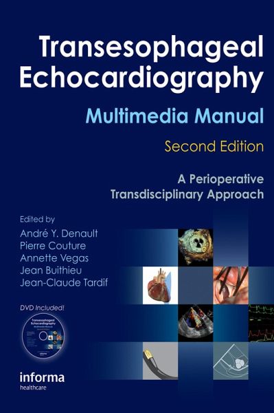 Transesophageal Echocardiography Multimedia Manual (eBook, ePUB)