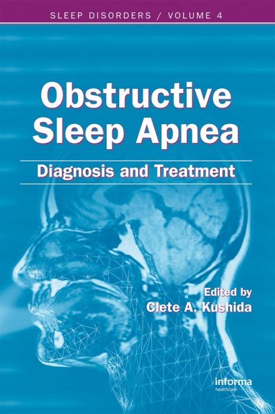 Obstructive Sleep Apnea (eBook, ePUB) Obstructive Sleep Apnea (eBook, ePUB)
