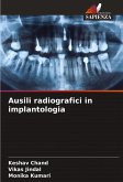 Ausili radiografici in implantologia Ausili radiografici in implantologia