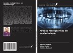 Ayudas radiográficas en implantología Ayudas radiográficas en implantología