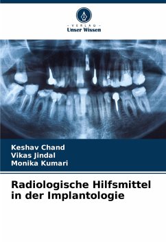 Radiologische Hilfsmittel in der Implantologie - Chand, Keshav;Jindal, Vikas;Kumari, Monika