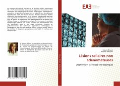 Cover Lésions sellaires non adénomateuses
