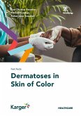 Fast Facts: Dermatoses in Skin of Color