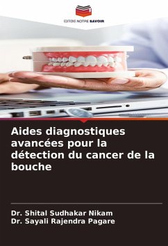 Aides diagnostiques avancées pour la détection du cancer de la bouche - NIKAM, DR. SHITAL SUDHAKAR;PAGARE, DR. SAYALI RAJENDRA