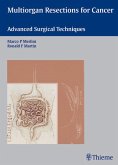 Multiorgan Resections for Cancer (eBook, ePUB) Multiorgan Resections for Cancer (eBook, ePUB)