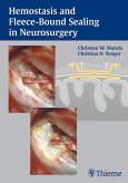 Hemostasis and Fleece-Bound Sealing in Neurosurgery (eBook, PDF)