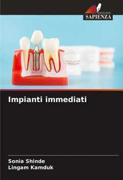 Impianti immediati - SHINDE, SONIA;KAMDUK, LINGAM