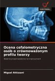 Ocena cefalometryczna osób o zrównowa¿onym profilu twarzy