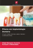 Pilares em Implantologia Dentária