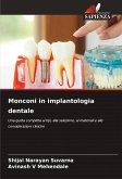 Monconi in implantologia dentale