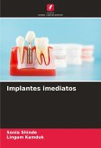 Implantes imediatos