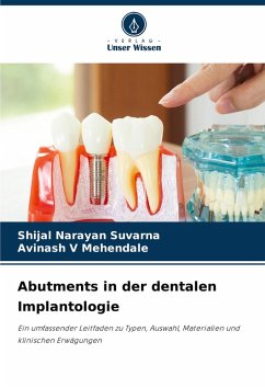 Cover Abutments in der dentalen Implantologie