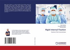 Rigid Internal Fixation Rigid Internal Fixation