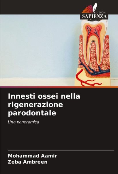 Innesti ossei nella rigenerazione parodontale Innesti ossei nella rigenerazione parodontale