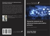 Gemación tumoral en el adenocarcinoma pancreático primario
