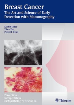 Breast Cancer - The Art and Science of Early Detection with Mammography (eBook, ePUB) - Tabar, Laszlo; Tot, Tibor; Dean, Peter B.