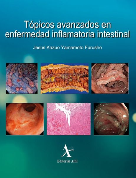 Tópicos avanzados en enfermedad inflamatoria intestinal (eBook, PDF) Tópicos avanzados en enfermedad inflamatoria intestinal (eBook, PDF)